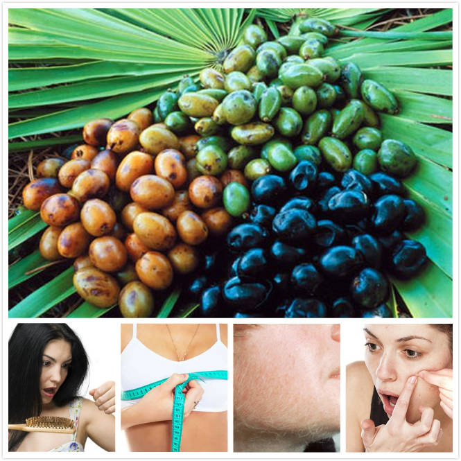 Using Saw Palmetto on Women: Benefits and Side Effects